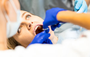 Chirurgia stomatologiczna